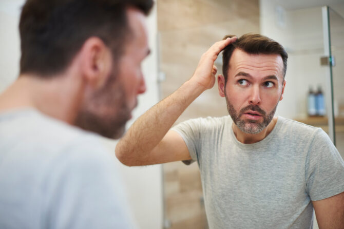 Hair loss in men and what can you do about it?